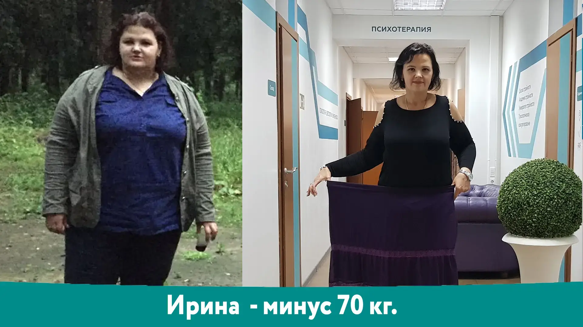 Ирина: результат снижения веса −70 кг, фотография до и после